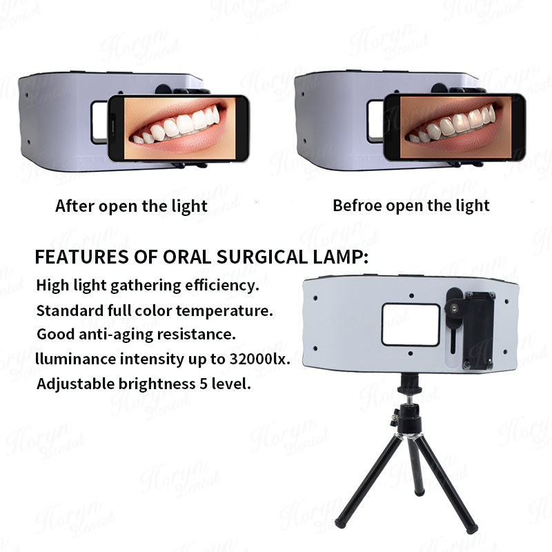 歯科用フラッシュライト,歯科医の写真機器,LED口腔充填ライ - Photography Dental のレビューと価格